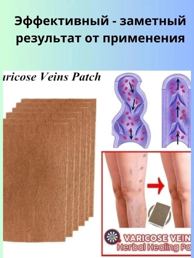 Артикул 22983752