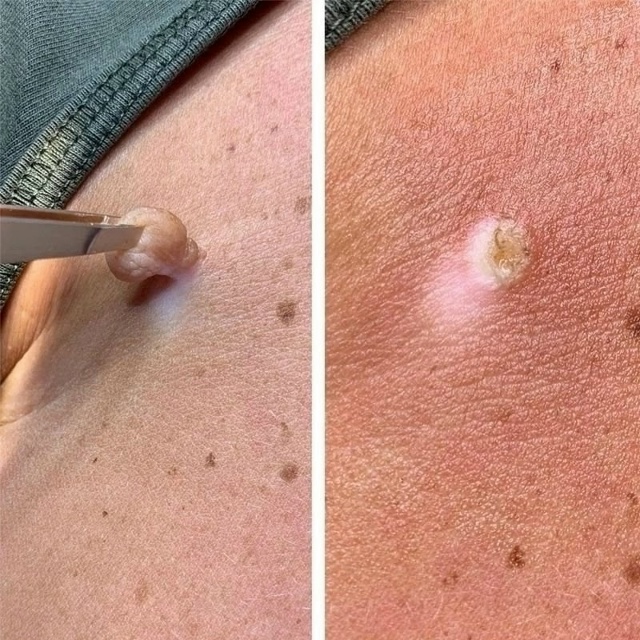 Сыворотка 23060551