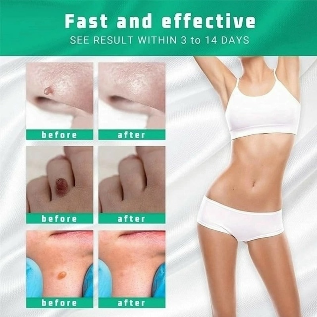 Сыворотка 23060551