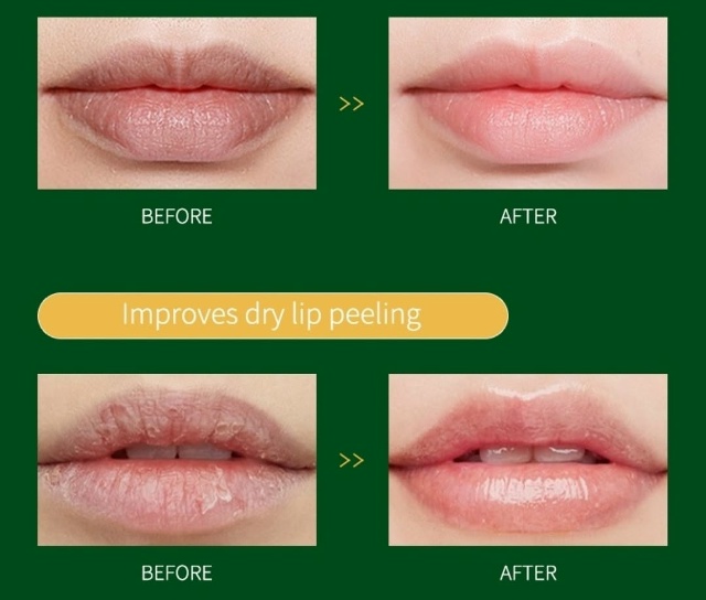 Комплект 23194707